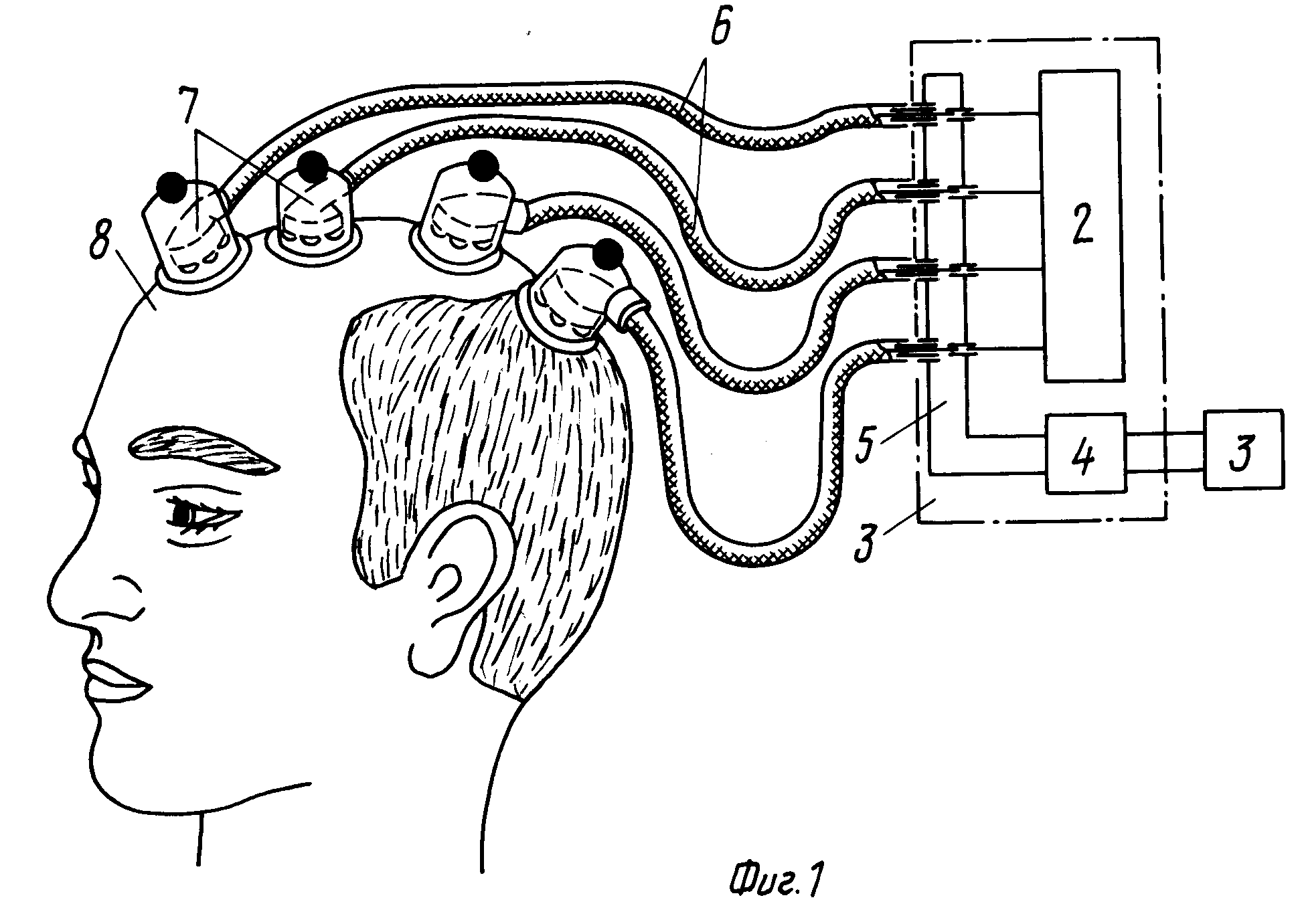 Чрезкожный нейростимулятор схема через. Устройство физиоотделения.