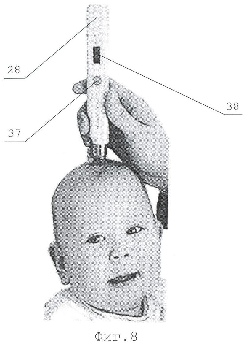 Измерение родничка. Измерение внутричерепного давления. Прибор для измерения внутричерепного давления. Аппарат для измерения внутричерепного давления головы. Прибор для измерения внутричерепного давления у детей.