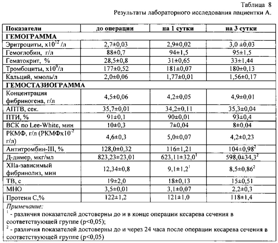 Натальная карта кесарево сечение