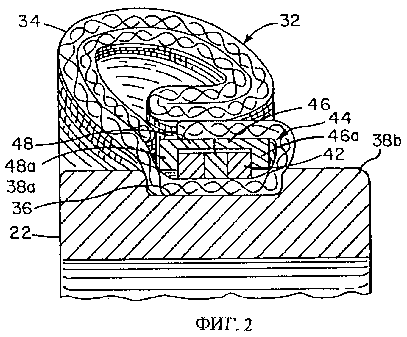пришить манжет к рукаву. пришивная манжета 8 букв. пришивная манжета 8 букв. вшивание манжета в рукаве. пришивная манжета 8 букв.