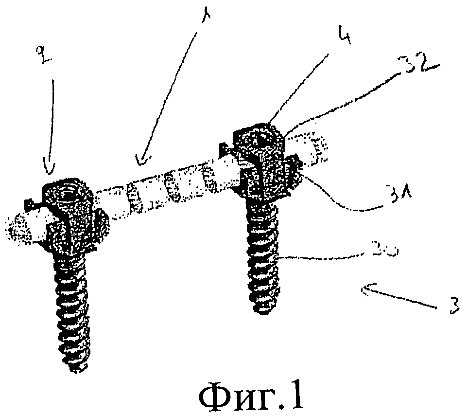 Смишек спиральная стабилизация